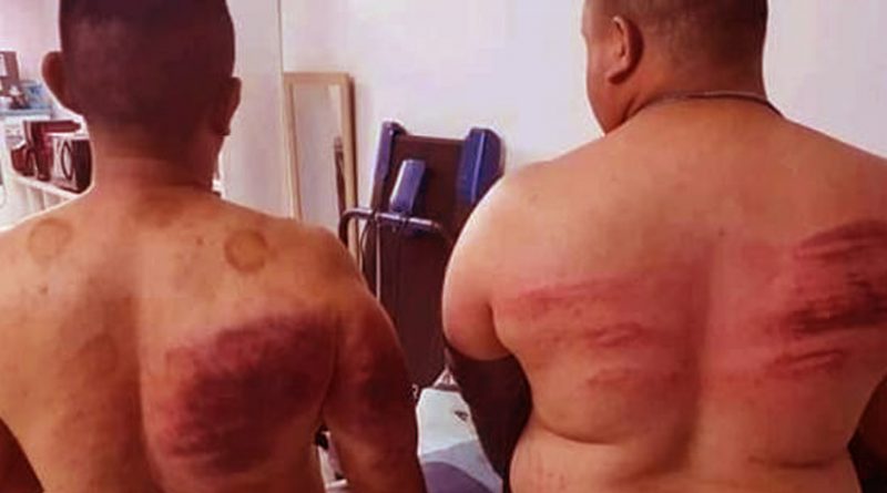 Dua bodyguard dipukul teruk oleh majikan kerana berpuasa ...